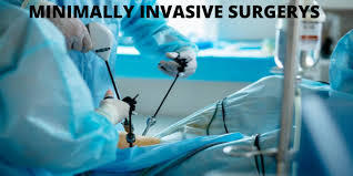 Minimally Invasive Surgery