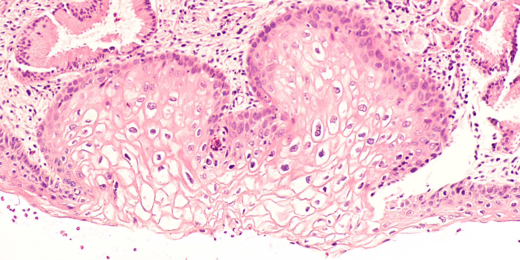 Pap Smears & HPV Testing